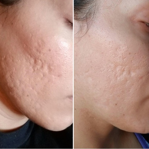 ✨🥇AWARD WINNING!🥇✨BIOSSANCE Squalane + Lactic Acid Resurfacing Night Serum - Picture 8 of 13